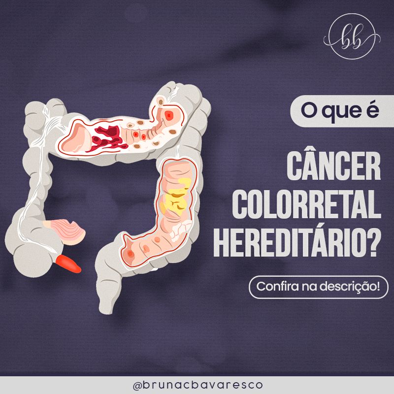 O Que é Câncer Colorretal Hereditário — Bruna Bavaresco 8230